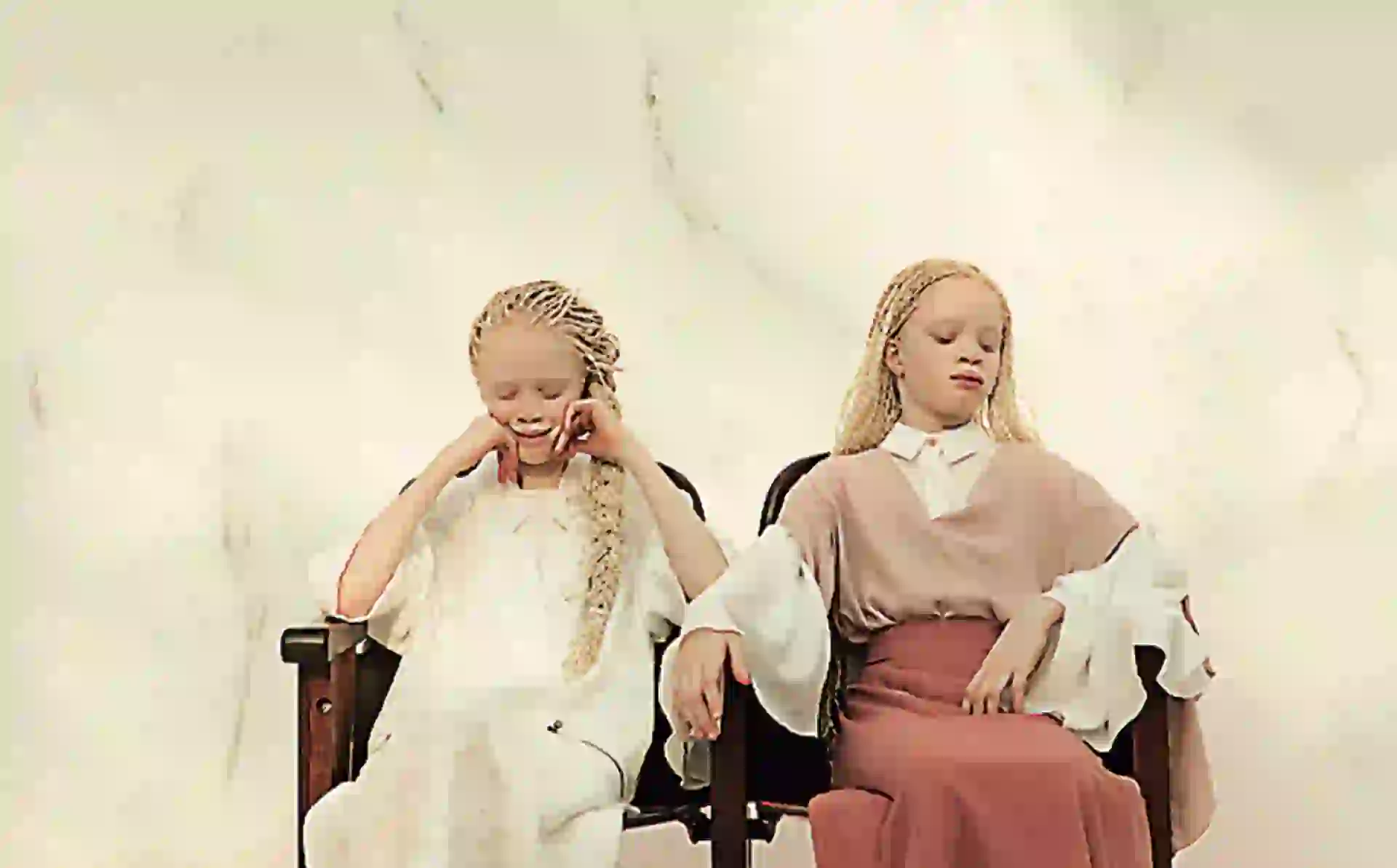 #PARA TI - MODELOS ALBINAS - News - 5 - 20171222