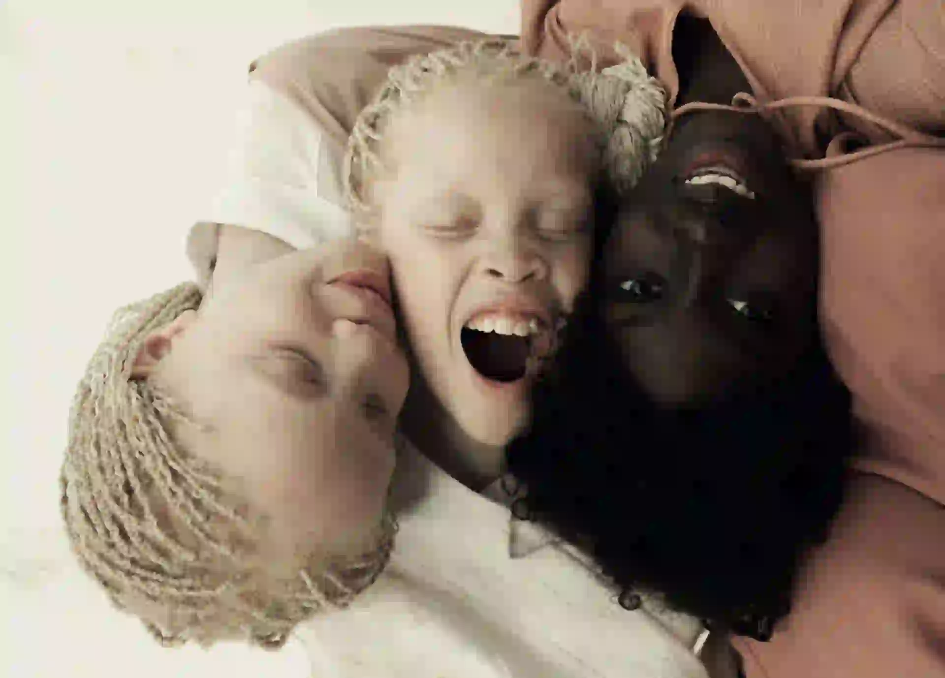 #PARA TI - MODELOS ALBINAS - News - 6 - 20171222