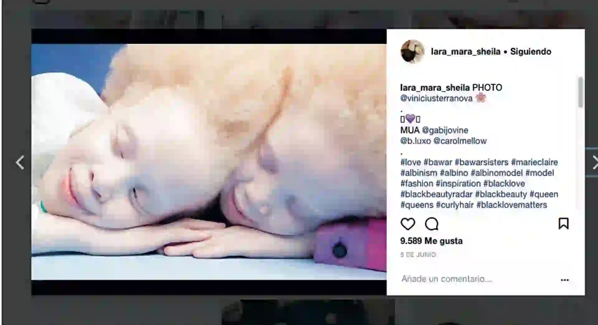 #PARA TI - MODELOS ALBINAS - News - Foto instagram 1 - 20171222