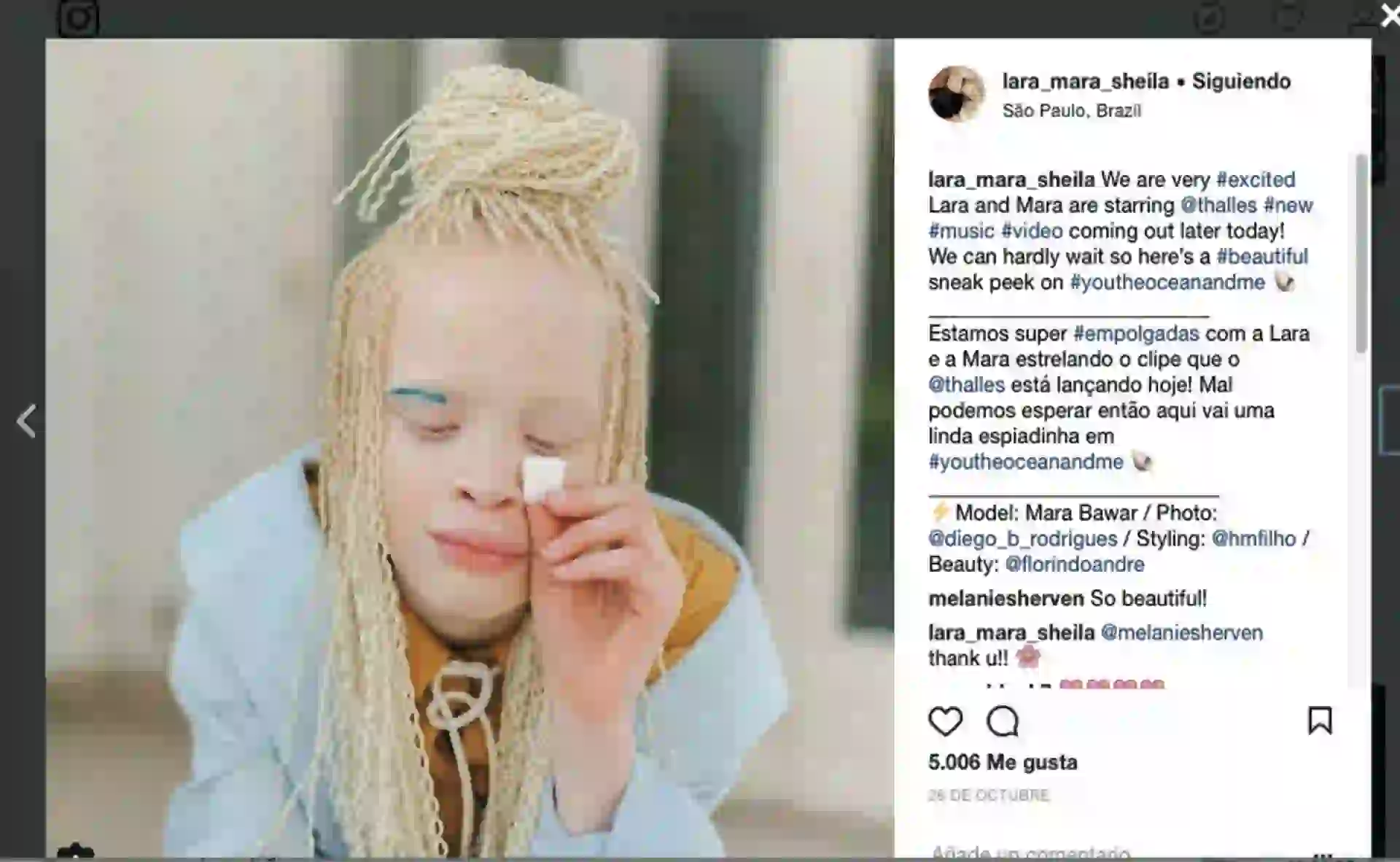 #PARA TI - MODELOS ALBINAS - News - Foto instagram 4 - 20171222