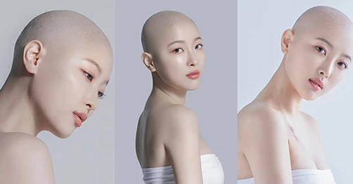 DAWN LEE YOUTUBER CANCER