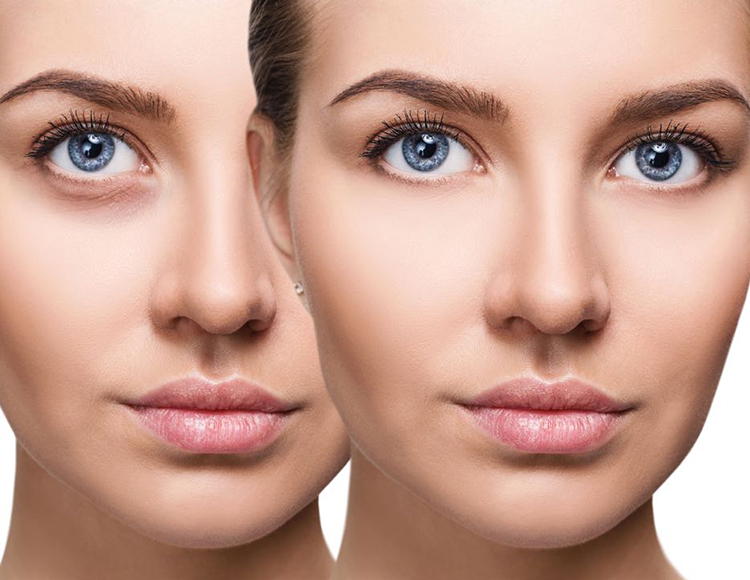 Lo más nuevo para combatir las ojeras y flaccidez de párpados