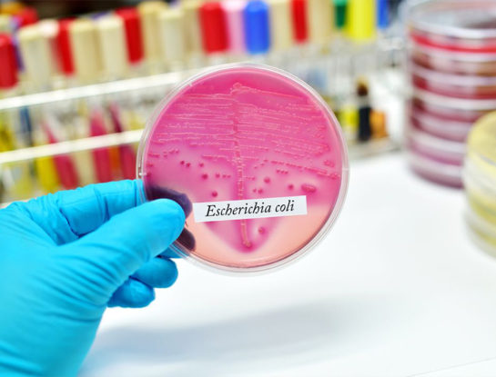 Qué es el síndrome urémico hemolítico, la enfermedad por la que murió un niño de 4 años tras comer una salchicha en mal estado