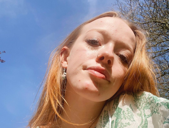 Amybeth McNulty, la protagonista de "Anne with an E" mostró un talento oculto que podría revelar su próximo trabajo