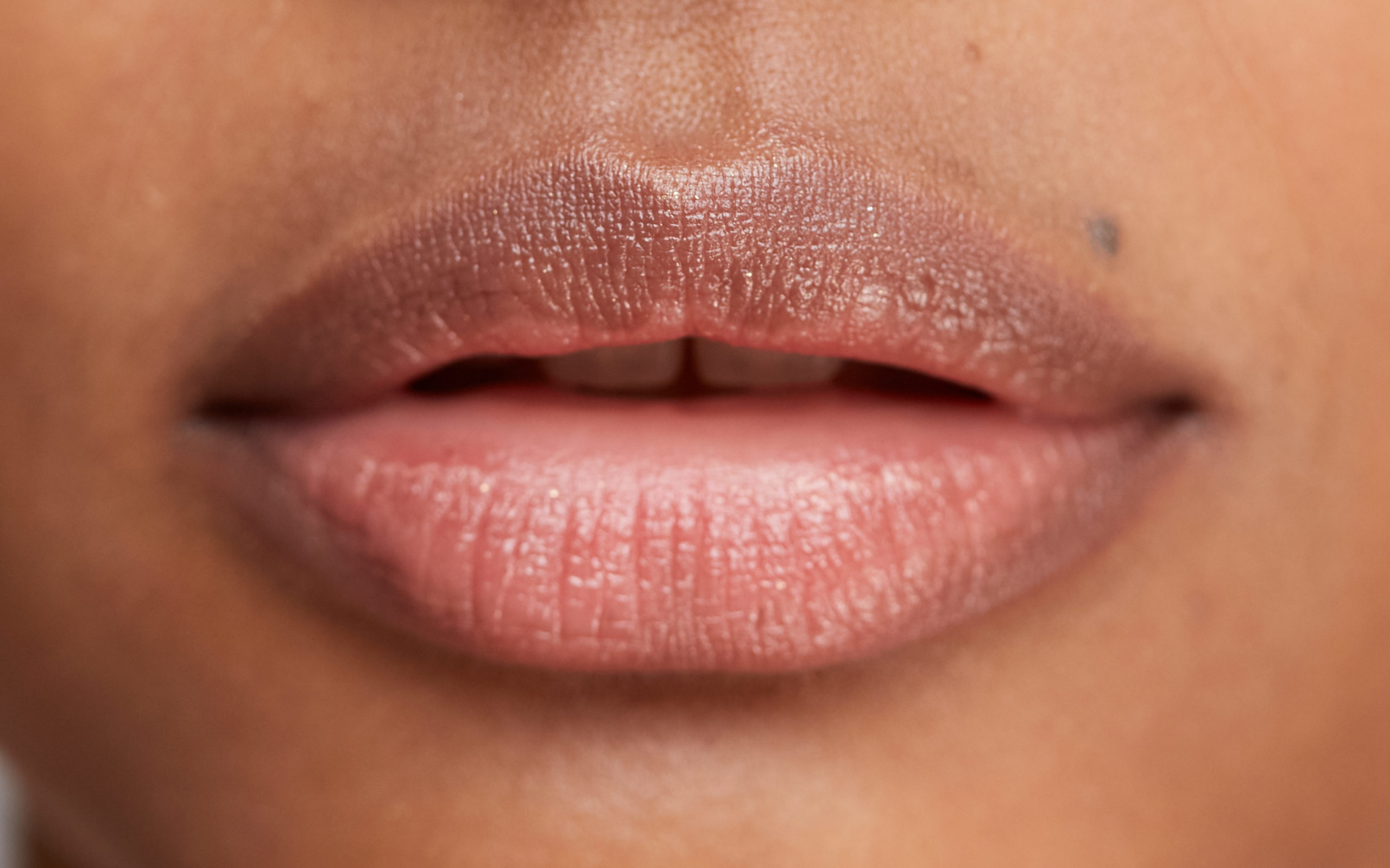 La imagen tiene un atributo ALT vacío; su nombre de archivo es allergan-aesthetics-image-031721-edited-scaled.jpg