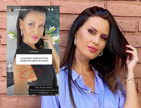 Natalie Weber conmovió al mostrar las cicatrices producto de su doble lucha contra el cáncer de mama