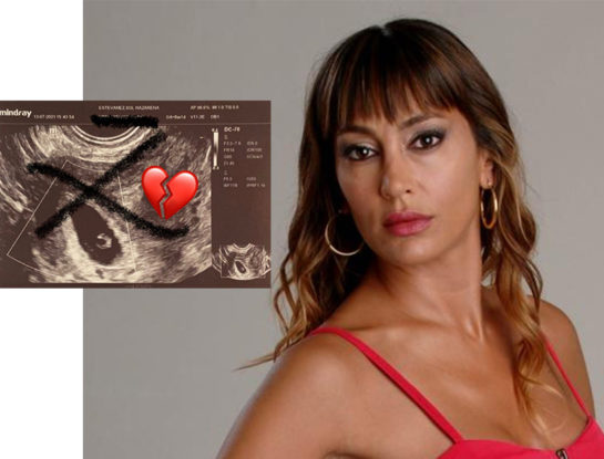 Qué es la Trisomía 18, el problema genético por el que Sol Estevanez perdió a su bebé