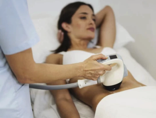 RO Medical, estética, tratamiento estético