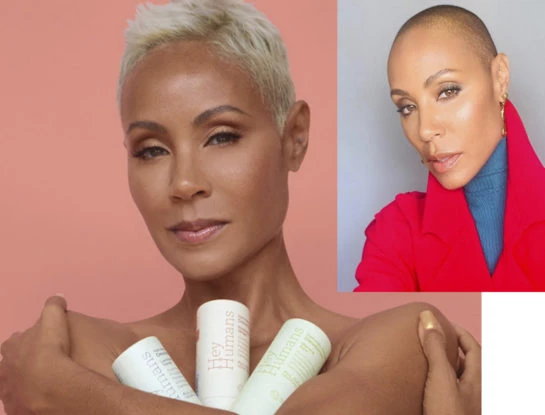 Cuál es la condición de Jada Pinkett, la mujer de Will Smith, que le impide que le crezca el pelo con normalidad
