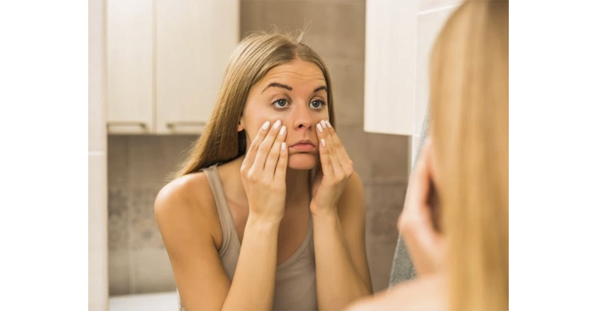 5 Consejos Para Combatir Las Bolsas De Los Ojos Revista Para Ti