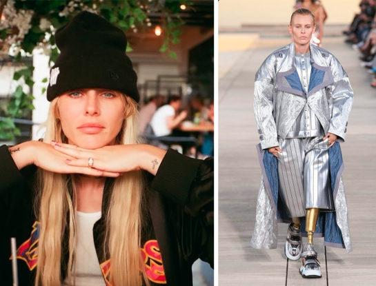 La historia de resiliencia de Lauren Wasser, la modelo que desfiló para Louis Vuitton con sus piernas ortopédicas: es activista y un ejemplo para el mundo