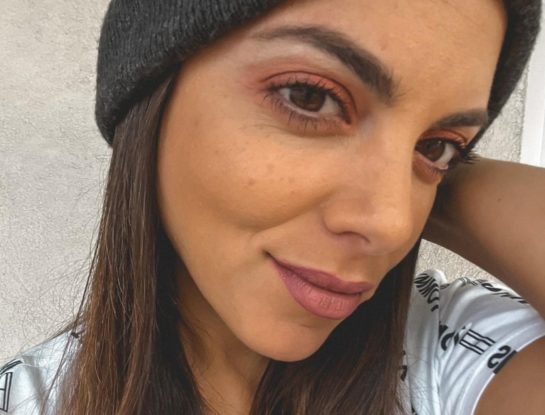 Belu Lucius mostró el resultado de su cirugía estética en el rostro