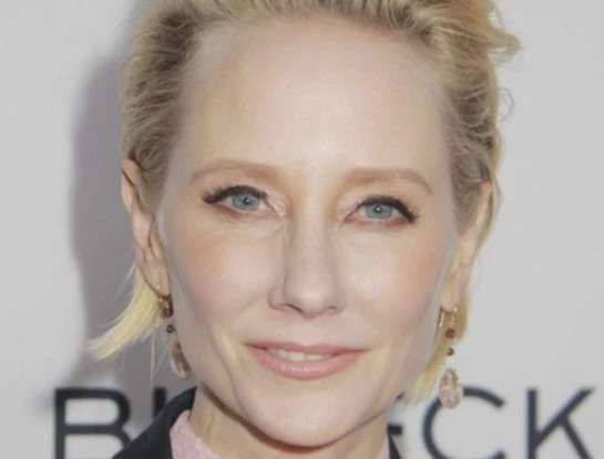 Así se veía Anne Heche antes del choque que la dejó en estado crítico