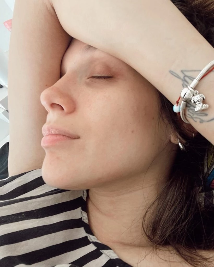 Barbie Vélez mostró los cambios en su piel debido a su embarazo