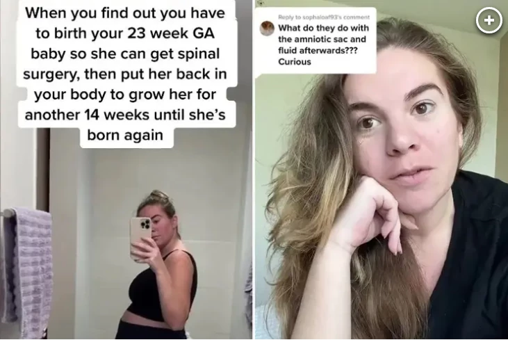 caso Jacqueline Schumer