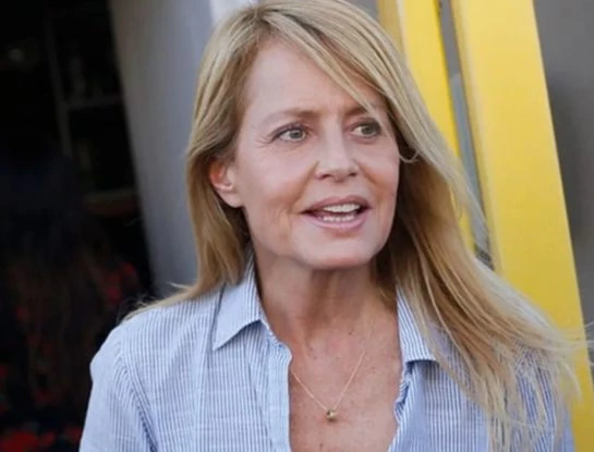 Cecilia Bolocco confesó el accidente doméstico que tuvo y mostró las secuelas