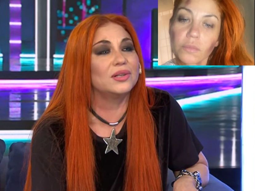 Qué dice el informe médico de Lowrdez de Bandana, tras haber sido agredida por su ex pareja