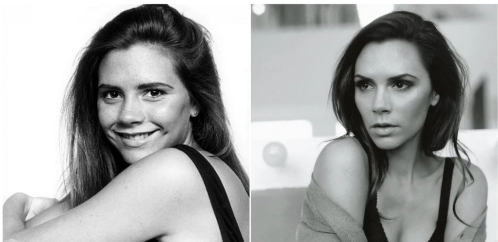 Victoria Beckham antes y después de la cirugía de nariz