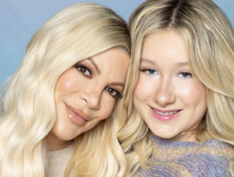Qué es la migraña hemipléjica, la afección que sufre Stella, la hija de 14 años de Tori Spelling