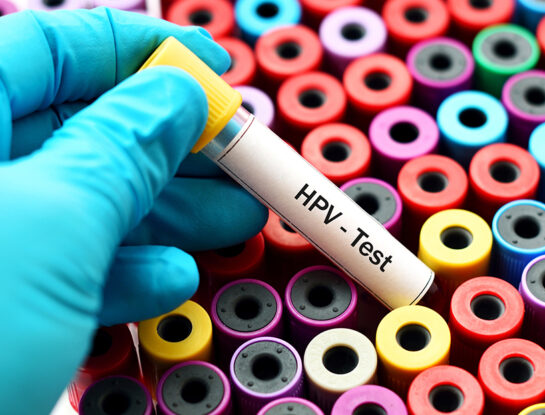 Cómo la biología molecular detecta el HPV, el virus que puede causar cáncer de cuello de útero