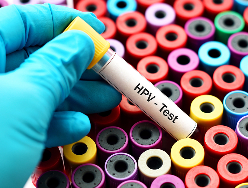 Cómo la biología molecular detecta el HPV, el virus que puede causar cáncer de cuello de útero