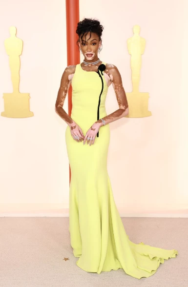 Winnie Harlow en los Oscar