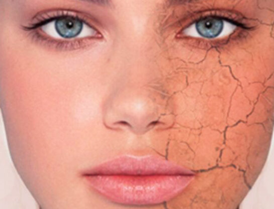 ¿Cómo se diferencia una piel seca de una deshidratada?
