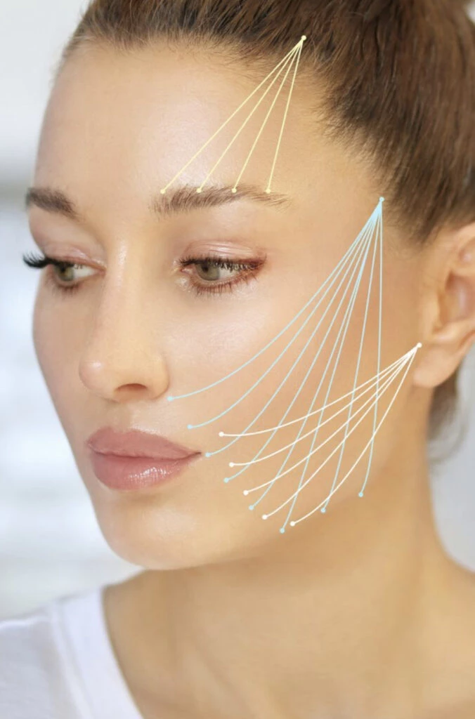 Nequi Galotti se puso hilos en su cara. Foto: Pinterest.