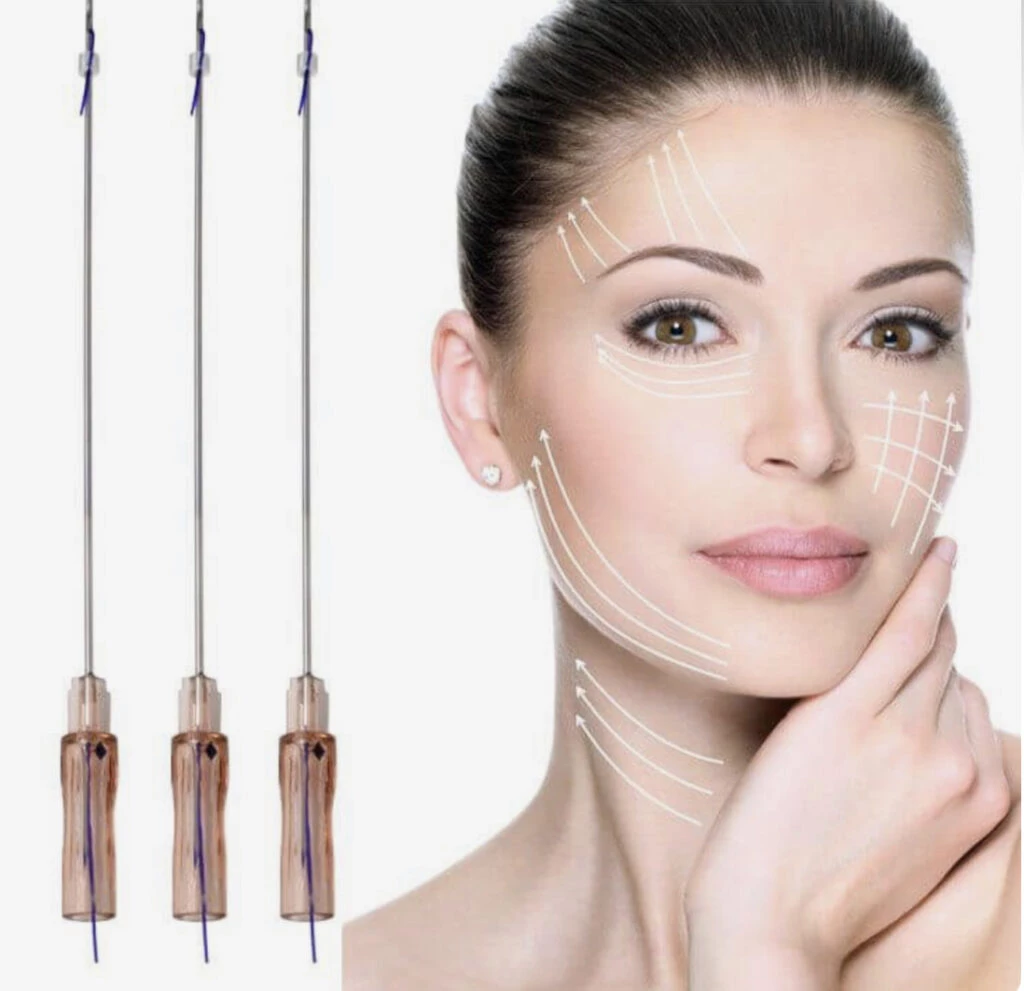 Nequi Galotti se puso hilos en su cara. Foto: Pinterest.