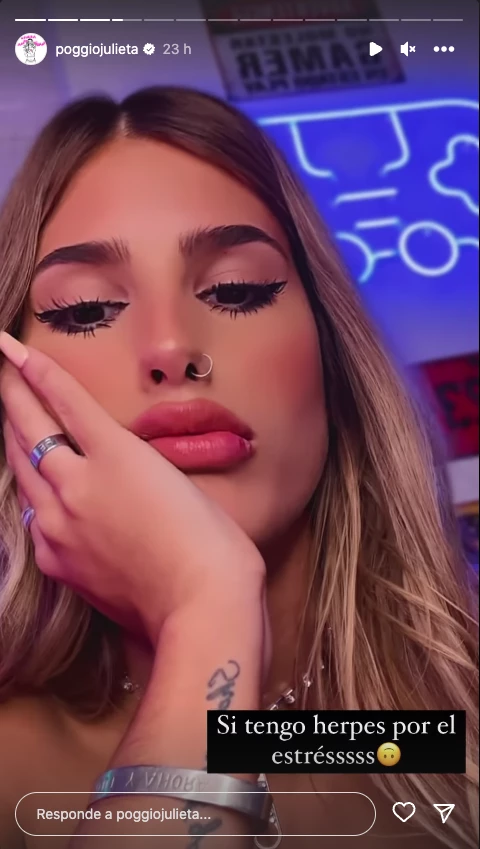 Julieta Poggio mostró cómo la afectó el estrés.