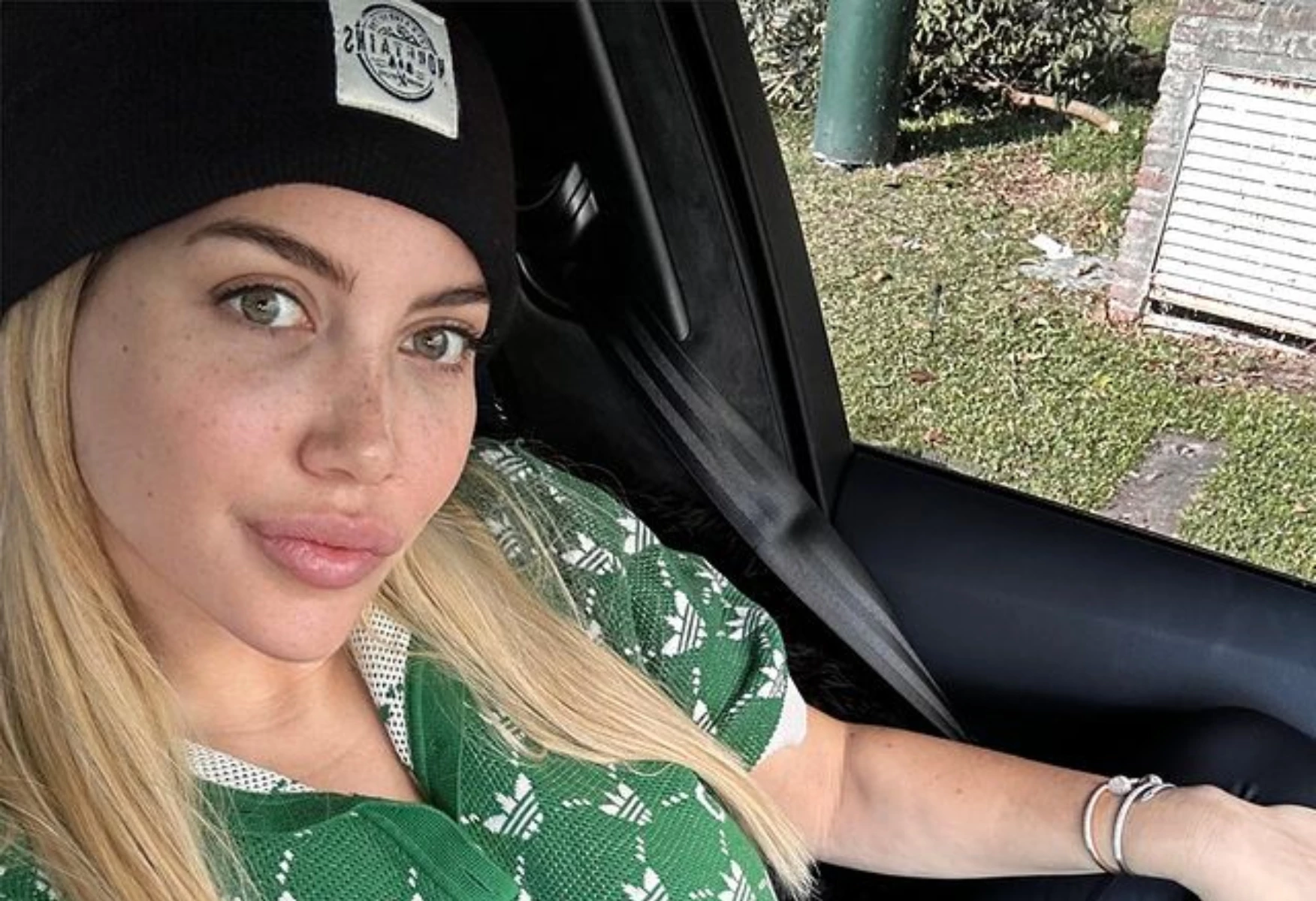 Marcela Tauro dio detalles del tratamiento de Wanda Nara