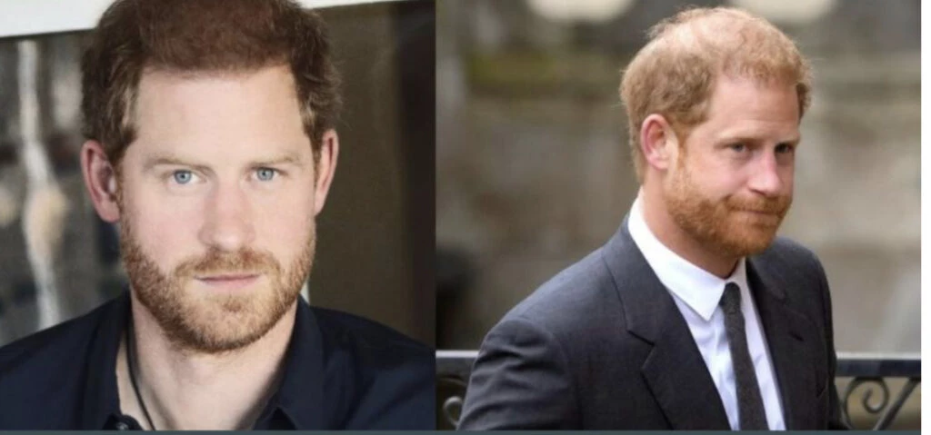 El nuevo look viral del príncipe Harry. Foto: web.