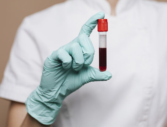 Qué personas son más propensas a padecerla y otras dudas acerca de la leucemia