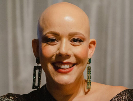 "Todos tenemos pelucas": la historia de vida y el mensaje resiliente de Michelle Faraco sobre la calvicie prematura