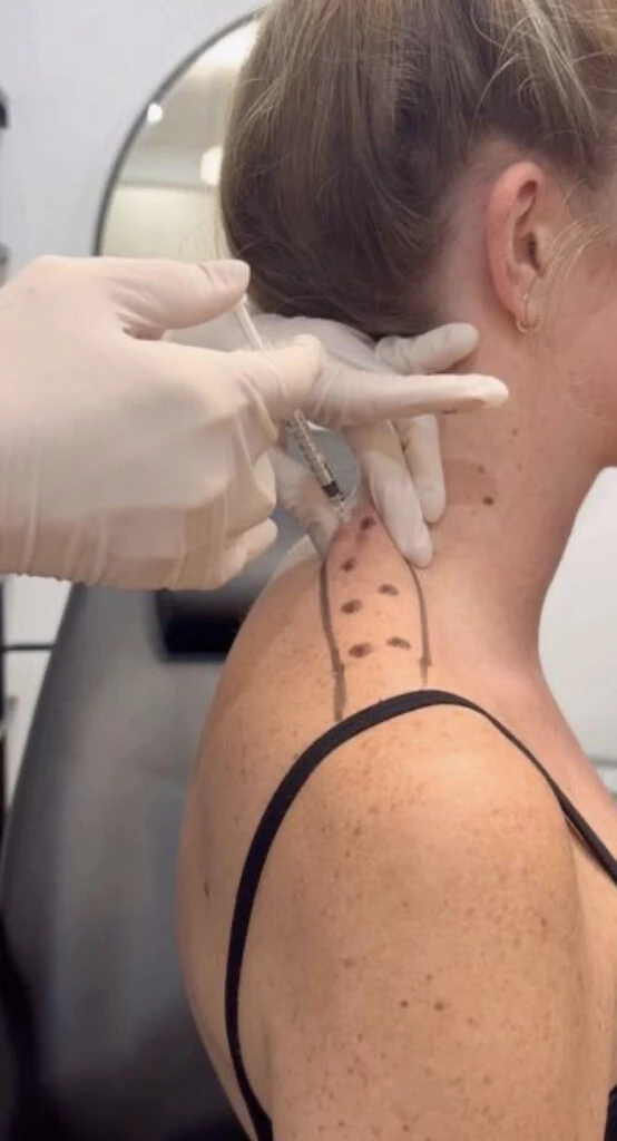 Así es el Barbie Botox. Foto: Pinterest.