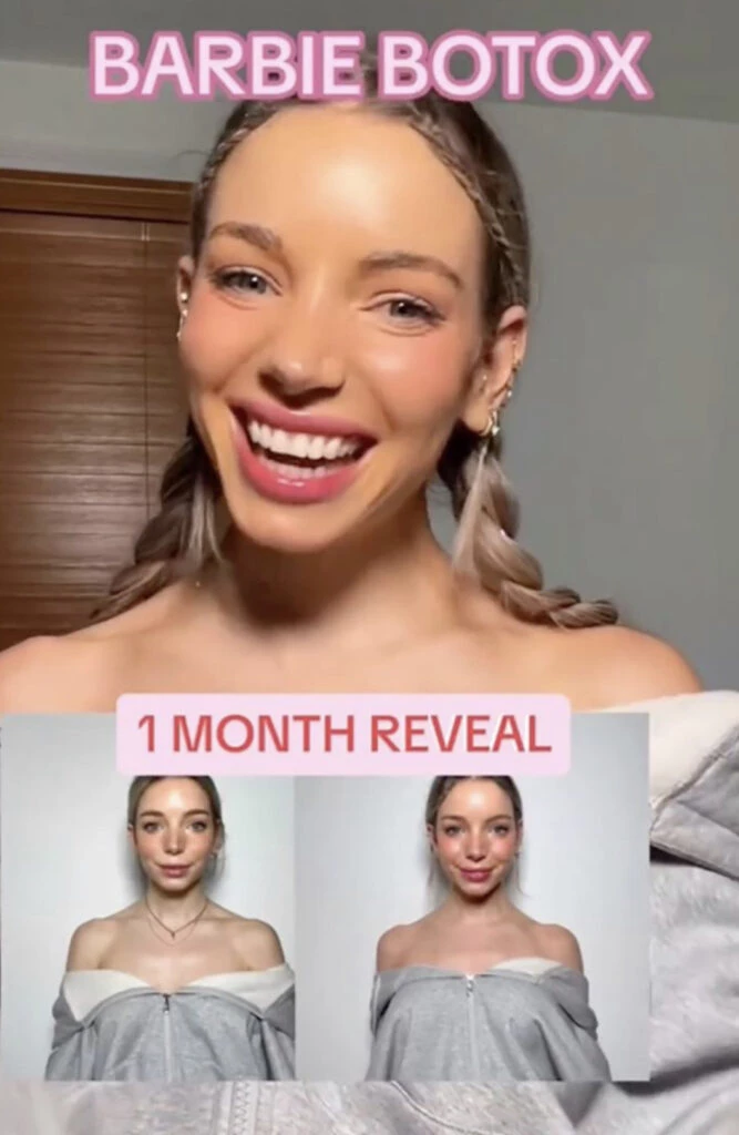 Así es el Barbie Botox. Foto: Pinterest.