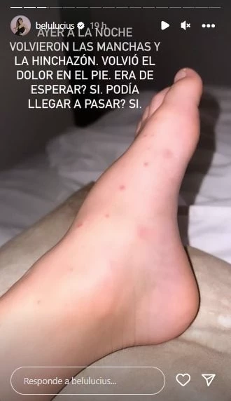 Belu Lucius mostró los pies de su hijo enfermo.