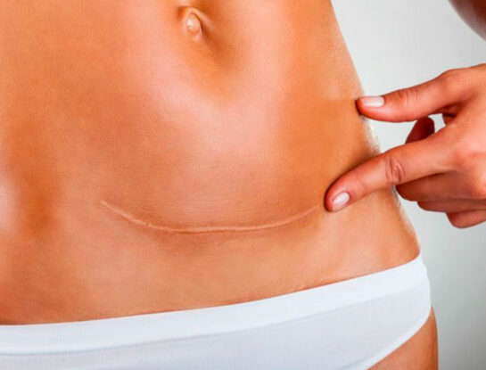 Transformar cicatrices: el enfoque innovador en la era de la dermatología