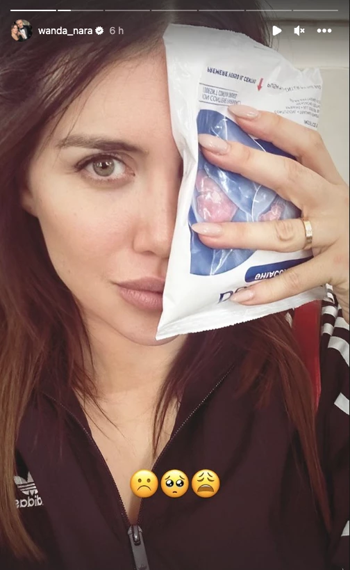 Wanda Nara se golpeó la cara.