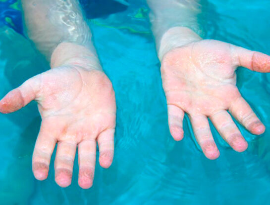 Por qué se nos arrugan los dedos en el agua y otras explicaciones detrás de algunas reacciones extrañas del cuerpo