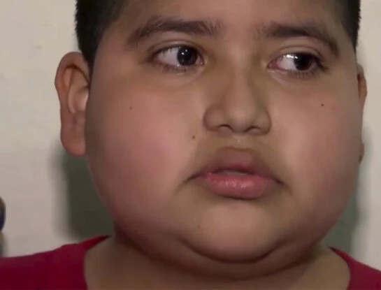 La historia de José Armando, el chico de 14 años que tomó la decisión de dejar la quimioterapia: por qué lo hizo