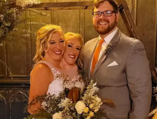 Las fotos de la boda secreta de la gemela siamesa Abby Hensel