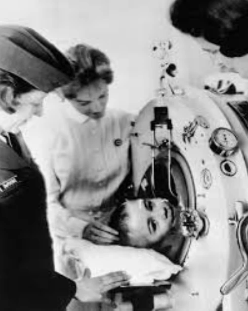 Paul Alexander cuando era niño: contrajo poliomielitis a los 6 años.