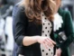 Kate Middleton embarazada: en sus tres gestaciones tuvo  hiperémesis gravídica