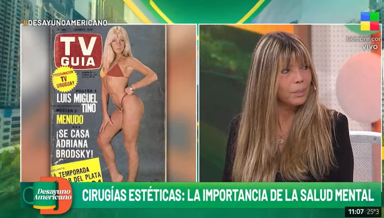 Adriana Brodsky contó que su tercera cirugía de nariz la ayudó porque le quedó mal 