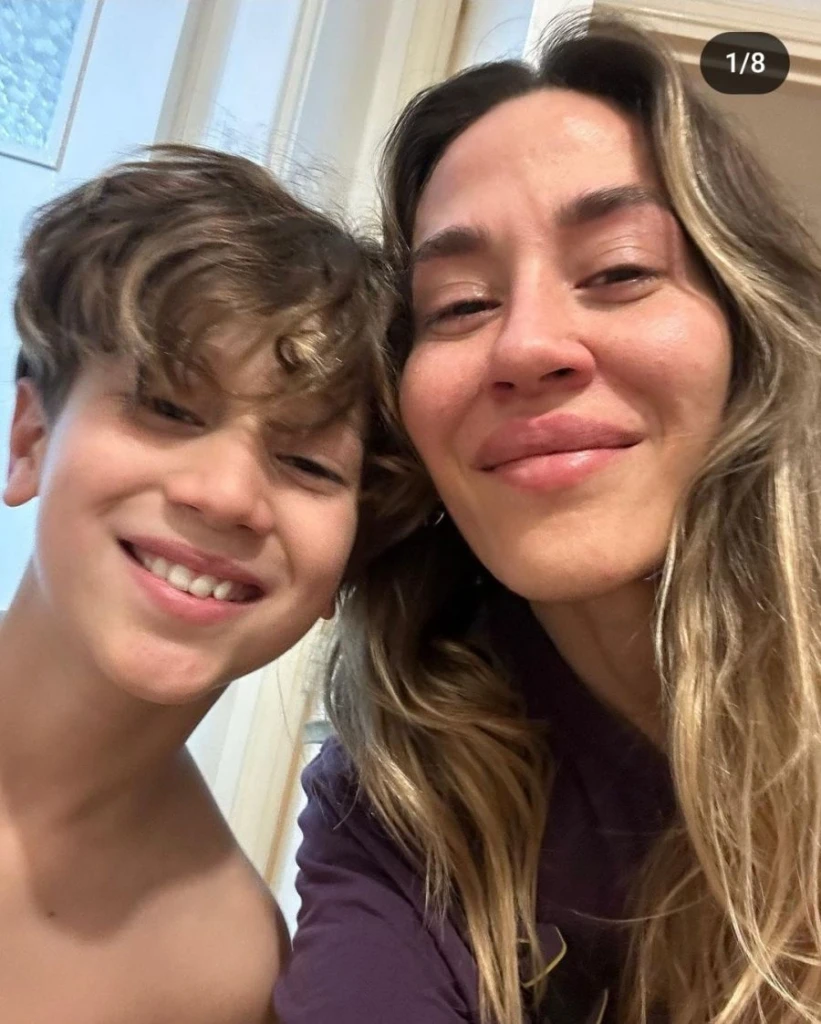 Este es el método de Jimena Barón para combatir las arrugas faciales