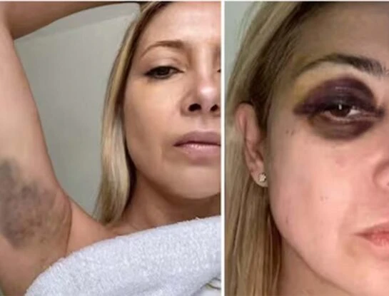 "La violencia de género no tiene clase o status social: afecta a todas por igual": la palabra de una experta