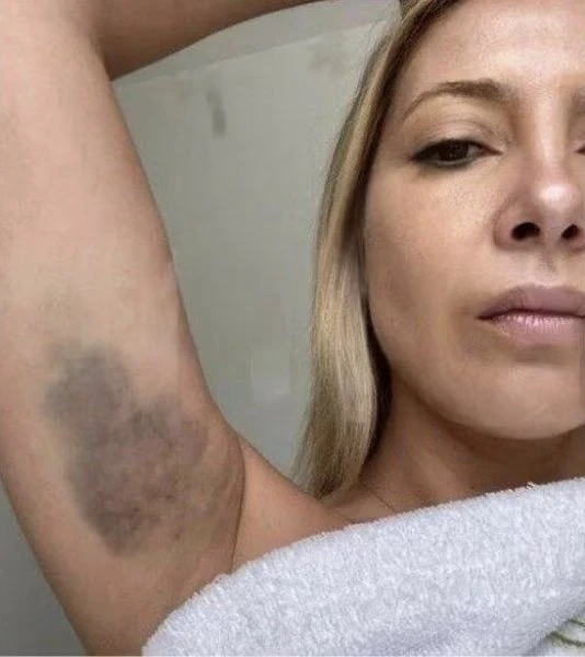 Los detalles íntimos de los momentos violentos que Fabiola Yáñez vivió con Alberto Fernández: "La encerraron para que no se vean los moretones"