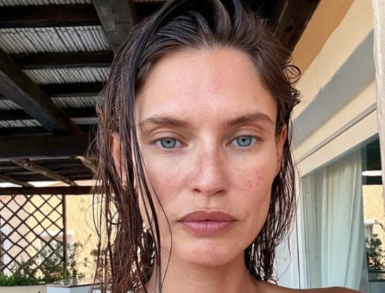 La top model que batalla contra el cáncer: había hecho una doble mastectomía preventiva y ahora la operaron de un cáncer de ovario en estadio 3