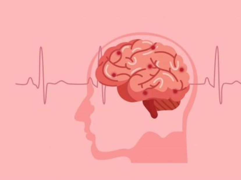 El test fácil y rápido para saber si una persona está teniendo un ACV